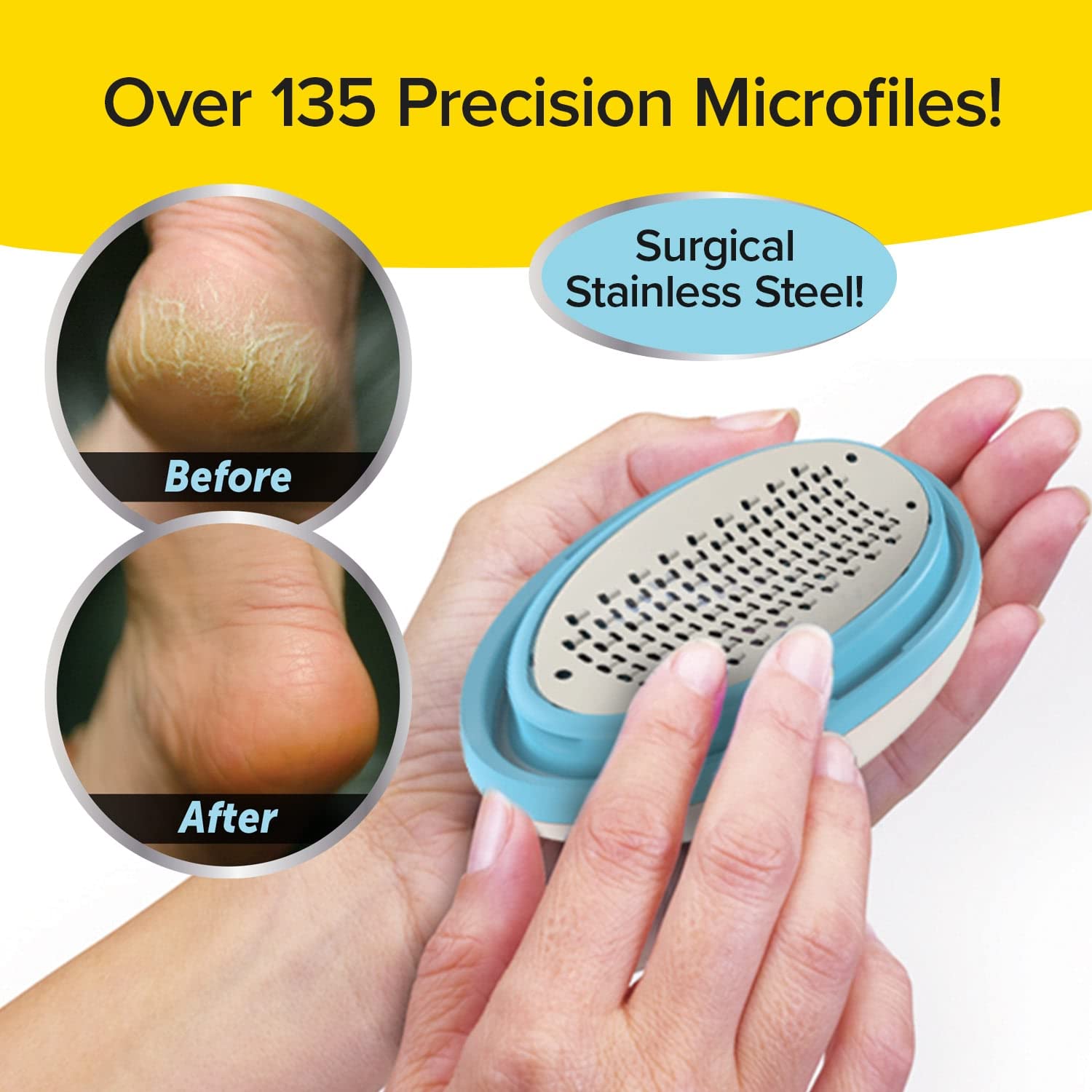 Ped Egg Gently Removes Calluses & Dry Skin Foot File Classic Find Your New Look Today!